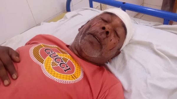 মুন্সীগঞ্জে জমি সংক্রান্ত বিরোধের জেরে হামলায় আহত-৩